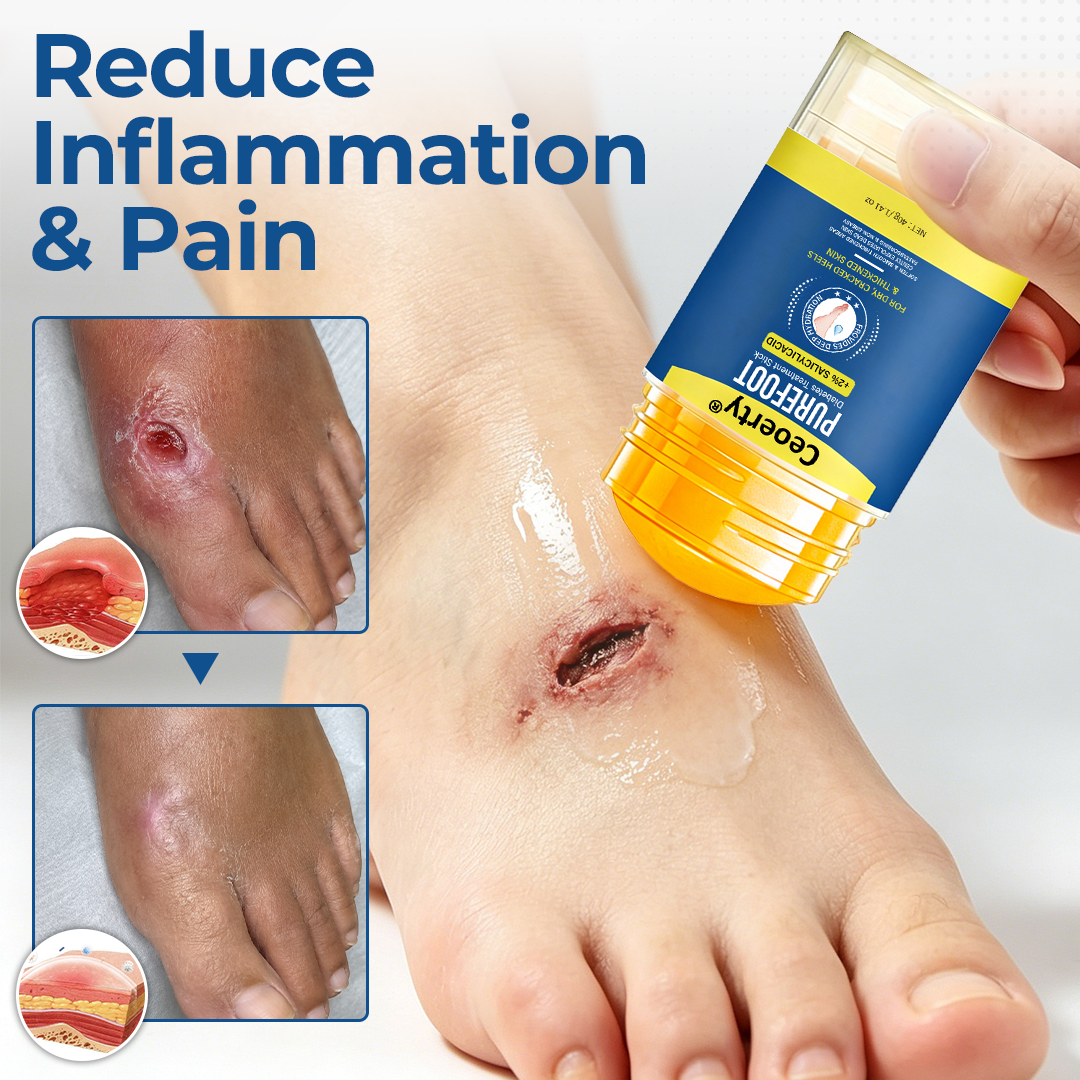 Ceoerty® PureFoot Foot Care Stick
