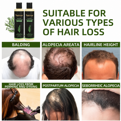 🌱 Organic Rosemary Hair Growth Shampoo