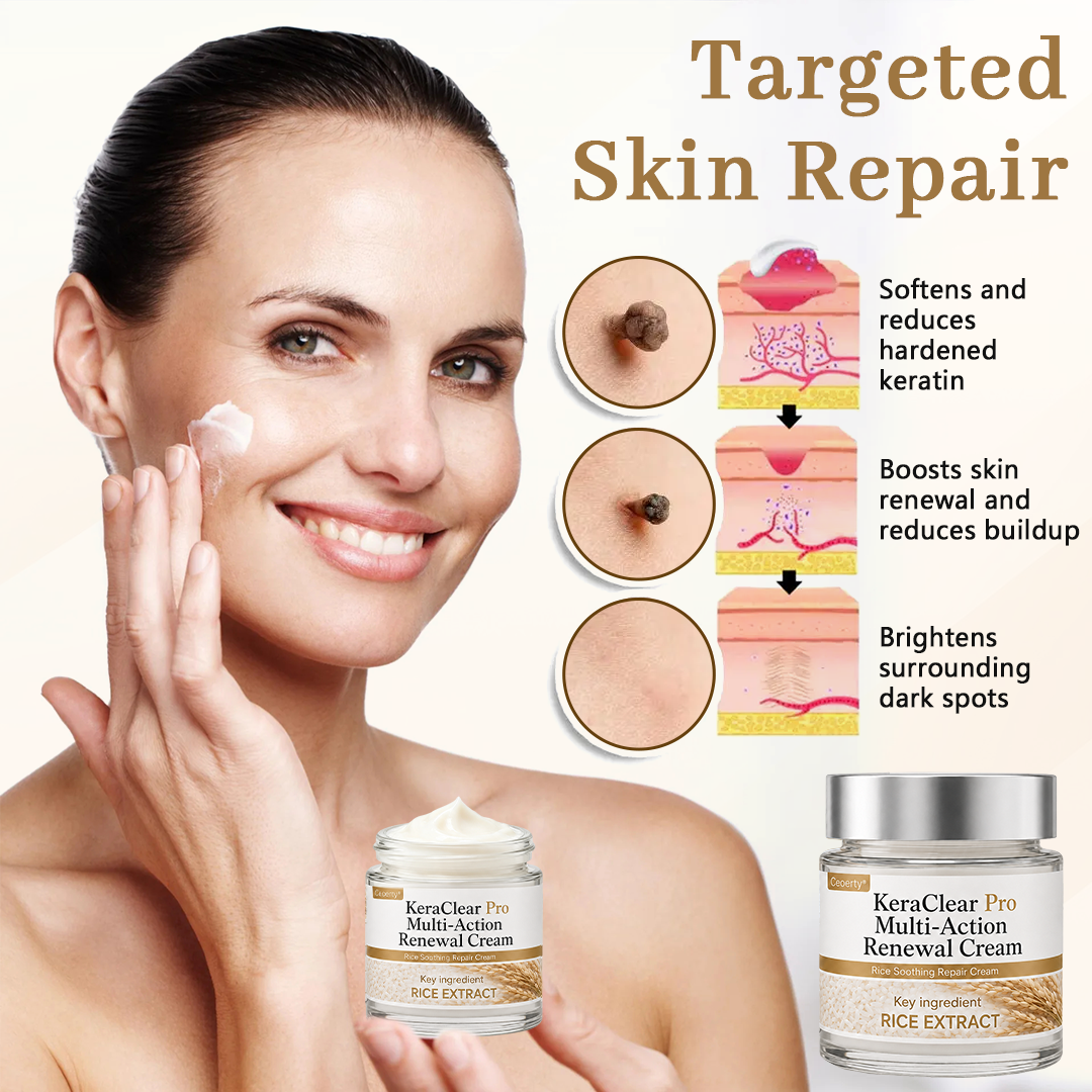 Ceoerty® KeraClear Pro Multi-Action Renewal Cream🌾✨