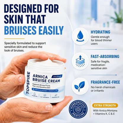 💥75K+ SOLD💕 TOPSPIRE® Arnica Bruise Cream