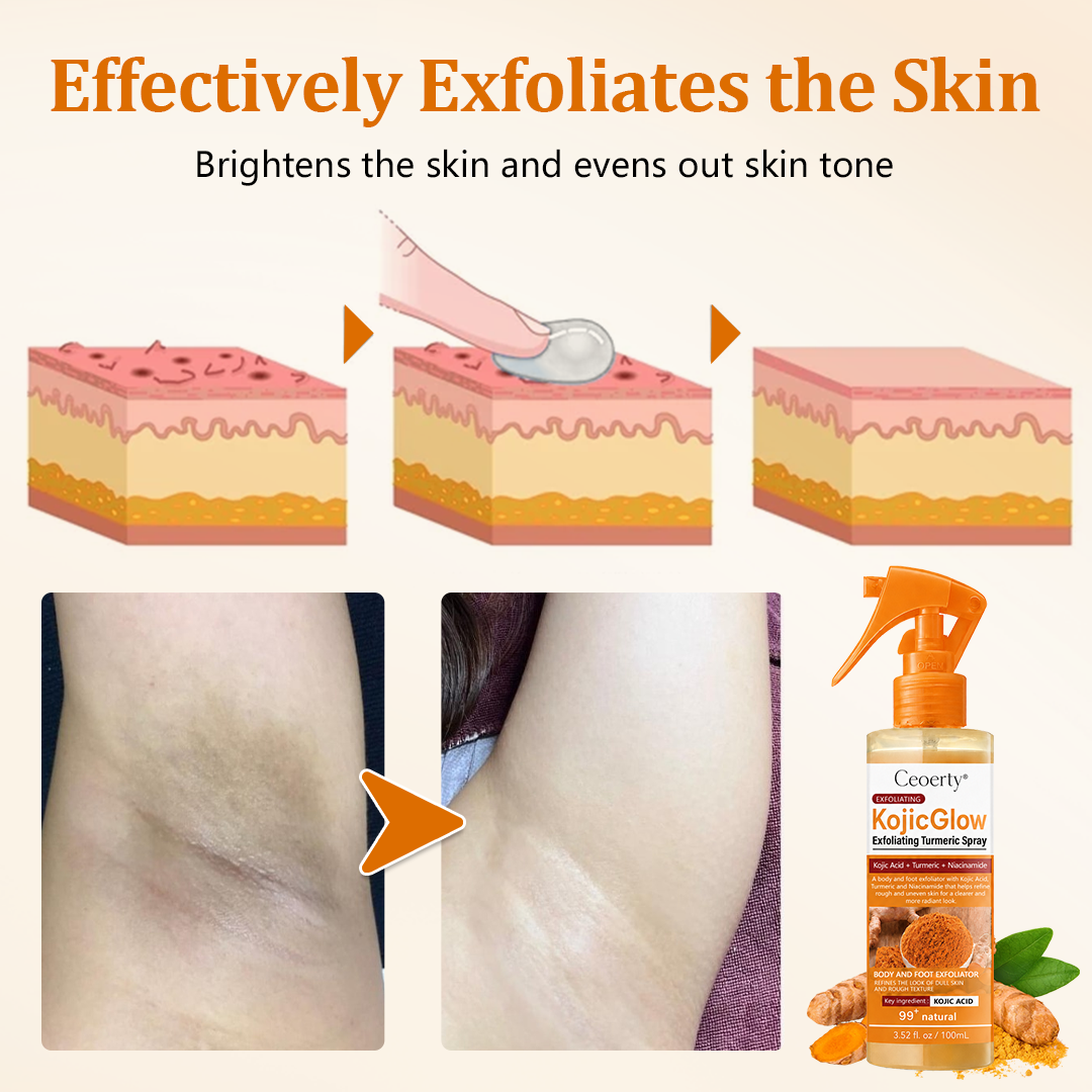 Ceoerty® KojicGlow Exfoliating Turmeric Spray