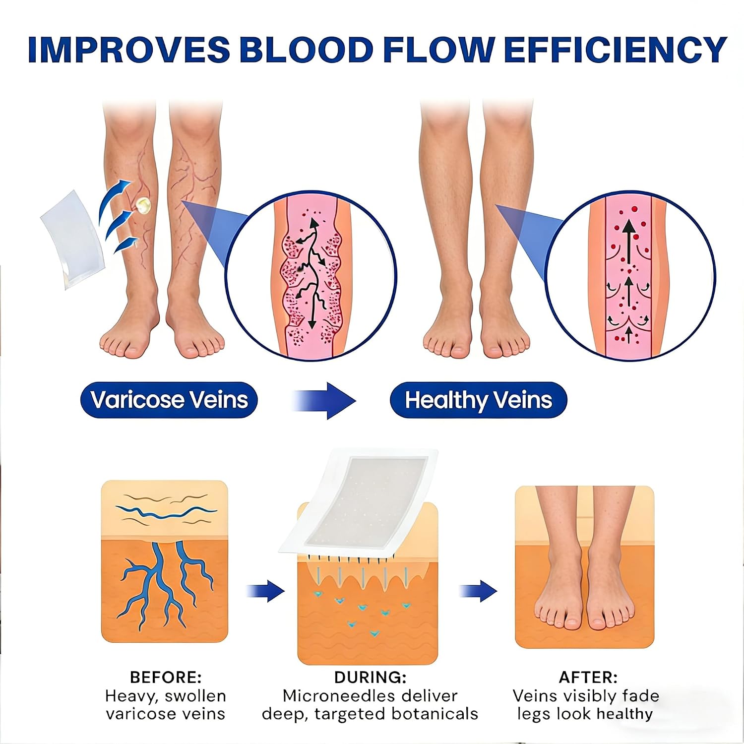 Instant Leg Relief: Micro-Dart Patches to End Throbbing Vein Pain