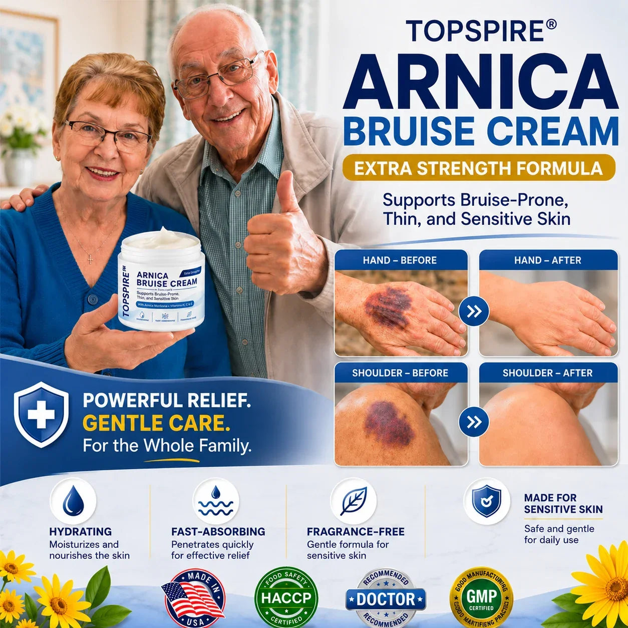 💥75K+ SOLD💕 TOPSPIRE® Arnica Bruise Cream