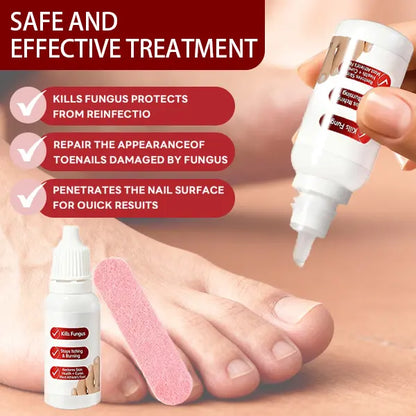 SOVS Toenail Fungus Treatment Extra Strength
