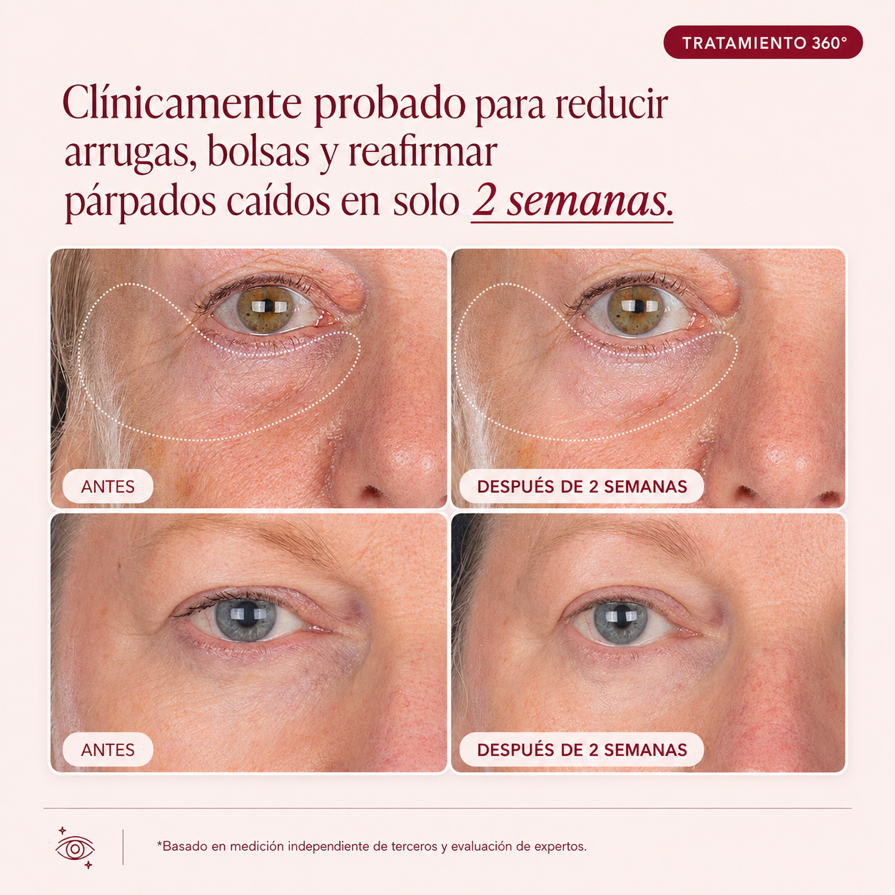Contorno de Ojos 360™ | Tratamiento Antiojeras y Antiedad