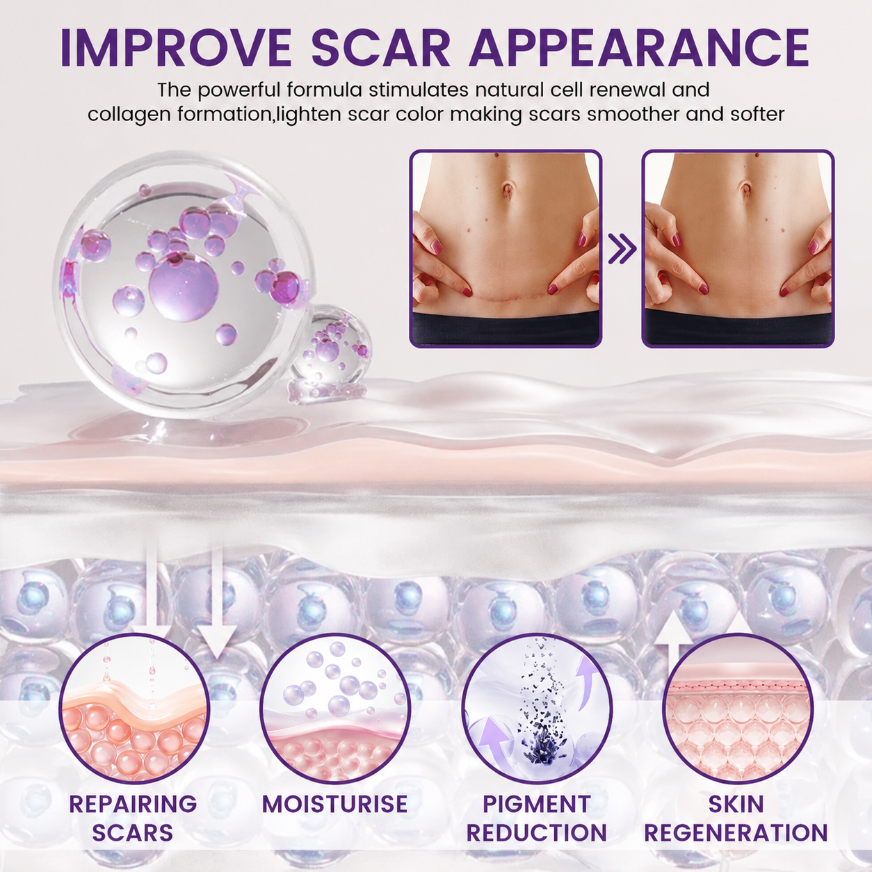 Rovinao® ReGenScar Stem Cell Scar Gel