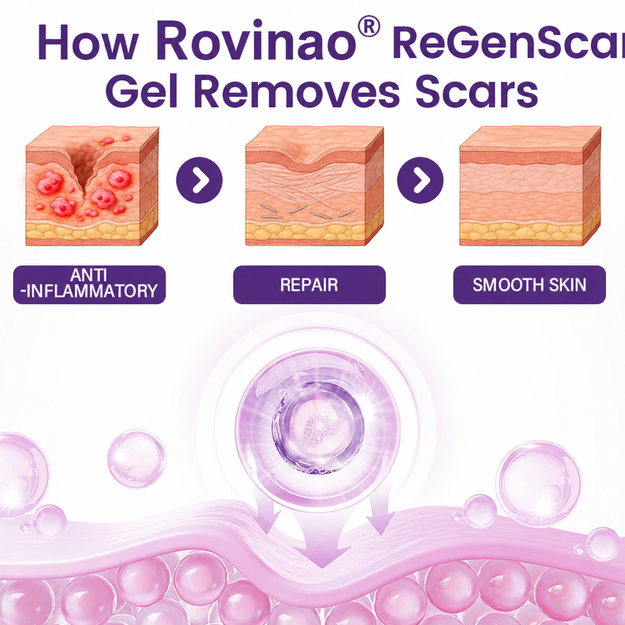 Rovinao® ReGenScar Stem Cell Scar Gel