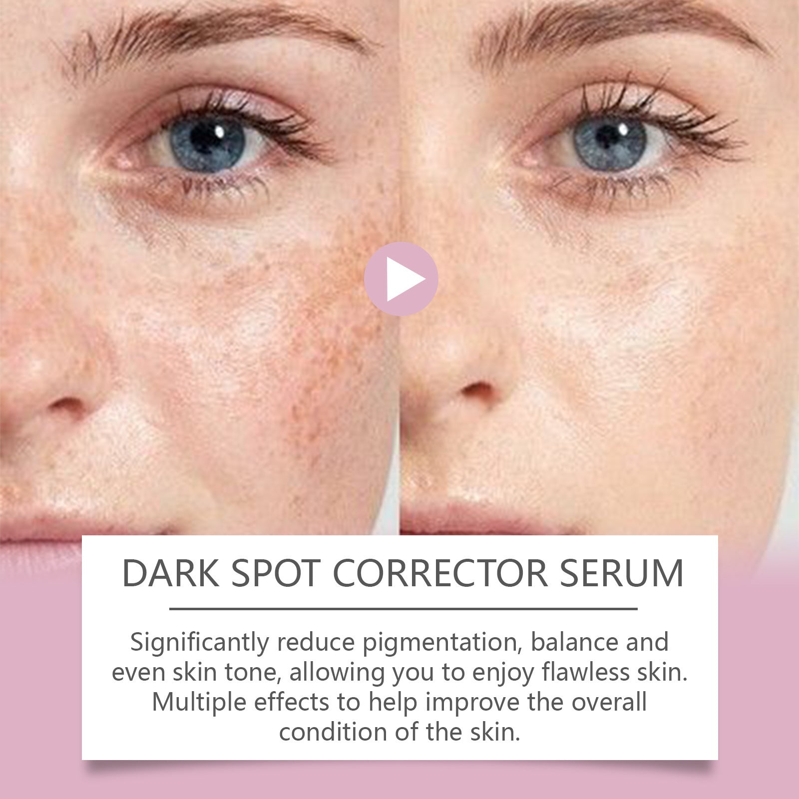 Advanced Dark Spot Corrector Serum - Multi-Correction Brightening Formula for Sun Spots, Age Spots, and Melasma-XXS