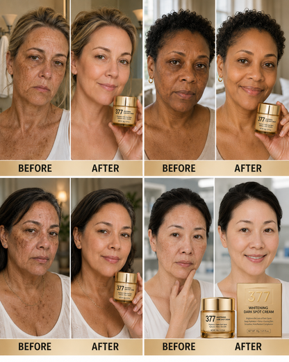 🔥 Limited Time Deal: Buy 1 Bottle, Get 1 FREE!  Thulox 377 Brightening SPF Face Cream – Dark Spot, Hydration & Anti-Wrinkle Care