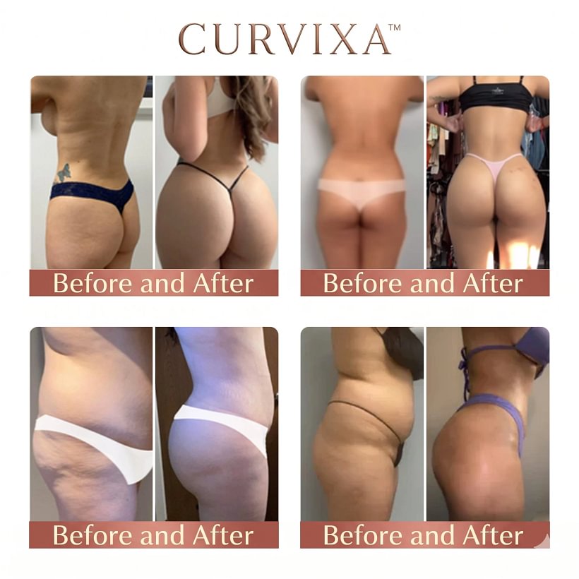 Curvixa™ CurveSculpt Butt Patch – Shape, Firm & Smooth Your Curves