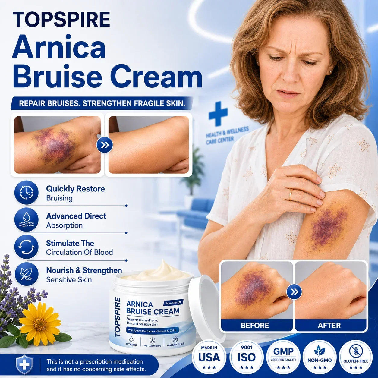 💥75K+ SOLD💕 TOPSPIRE® Arnica Bruise Cream