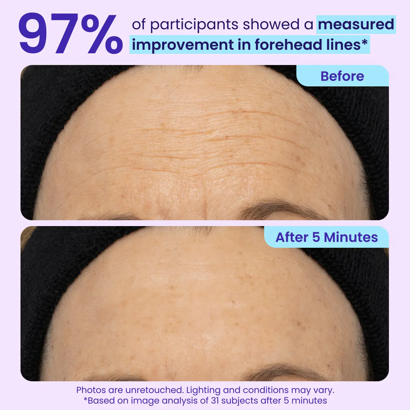 Eye Bag Instant Eraser, Tightens, Firms, & Blurs Wrinkles